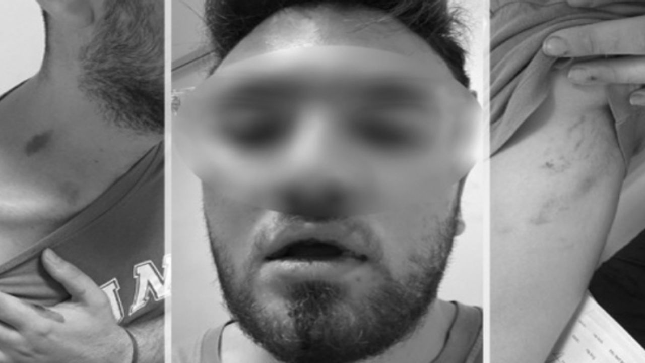 'Tıp Fakültesi öğrencileri, emlakçı tarafından darbedildi'