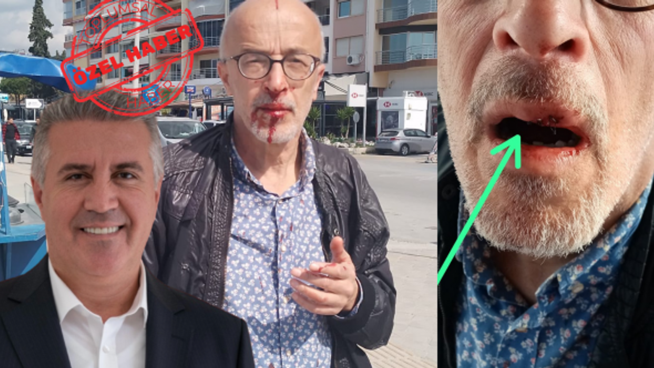 Fotoğrafa inanmayın, asıl saldırıya uğrayan benim komedisi!