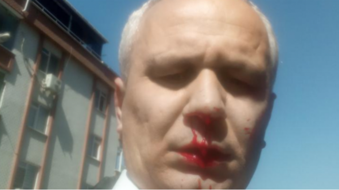 Yazarımız Cemil Kılıç'a saldırıda 2 gözaltı