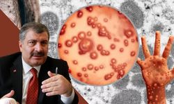 Maymun çiçeği virüsü Türkiye'de var mı? Fahrettin Koca'dan yeni açıklama