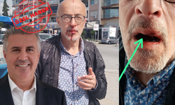 Fotoğrafa inanmayın, asıl saldırıya uğrayan benim komedisi!