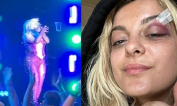 Ünlü şarkıcının yüzüne konserde telefon fırlatıldı