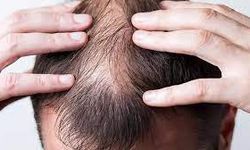Saç dökülmesine karşı yapılacak önlemler