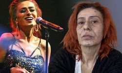 Yıldız Tilbe'nin yüzü saç boyasından yandı