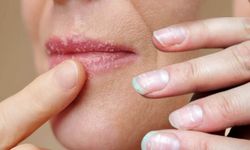 Bu Belirtiler Varsa Dikkat: Demir Eksikliği Olabilir mi?