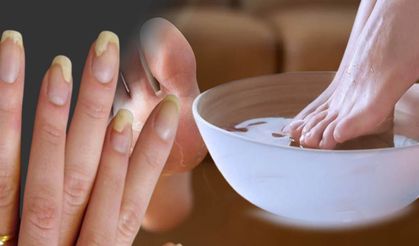El ve ayak mantarı geçmiyorsa evde bunları dene