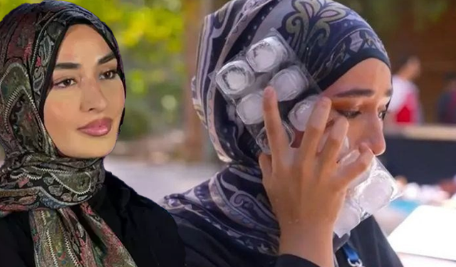 Yüzünü kızgın yağla yakan MasterChef yarışmacısı Beyza'nın sağlık durumu açıklandı