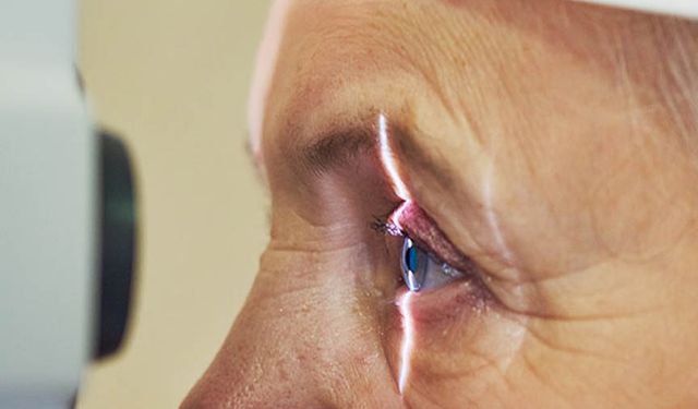 Astigmat lazer tedavisi kimler için uygun?