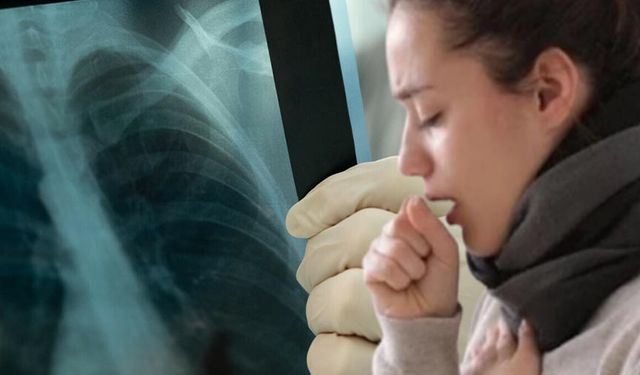 Akciğer Kanserinde Erken Teşhis İçin Geç Kalmayın!