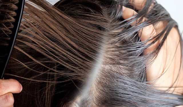 Saç neden yağlanır: İşte doğal çözümler