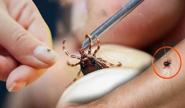 Kene vakaları arttı: Uzmanlardan peş peşe uyarı