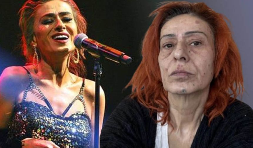 Yıldız Tilbe'nin yüzü saç boyasından yandı