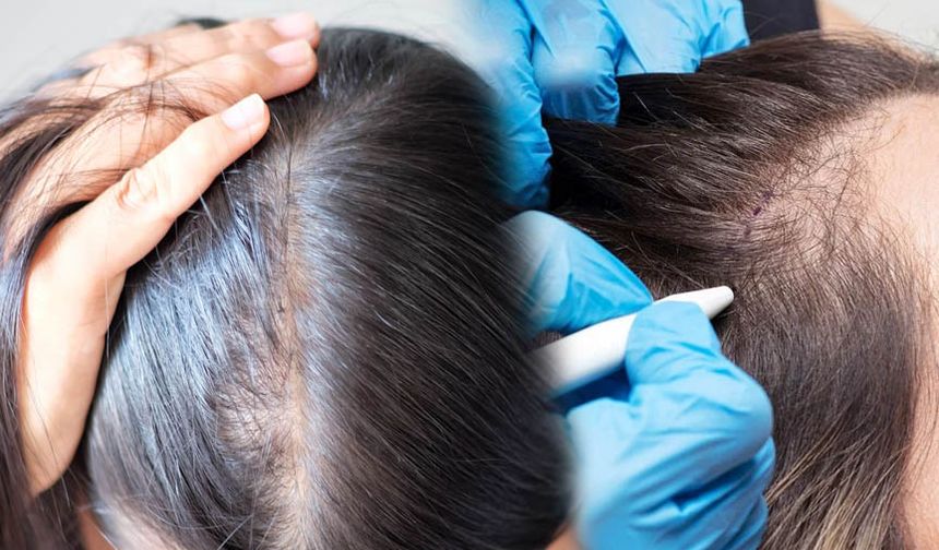 Saç Ekimi Tarih Oluyor! 7 Alternatif Çözüm