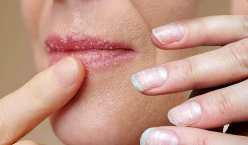 Bu Belirtiler Varsa Dikkat: Demir Eksikliği Olabilir mi?