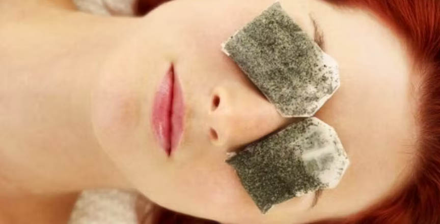 Çay Posası Gözaltı