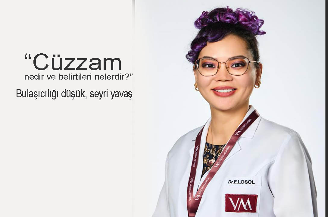 Cüzzam Neden Olur Uzmandan Aciklama