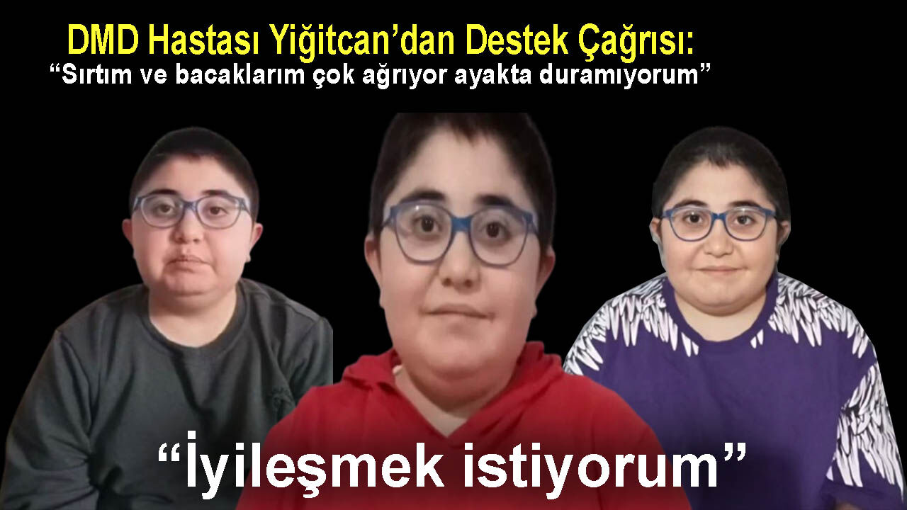 Dmd Hastaligi Nasil Tedavi Edilir